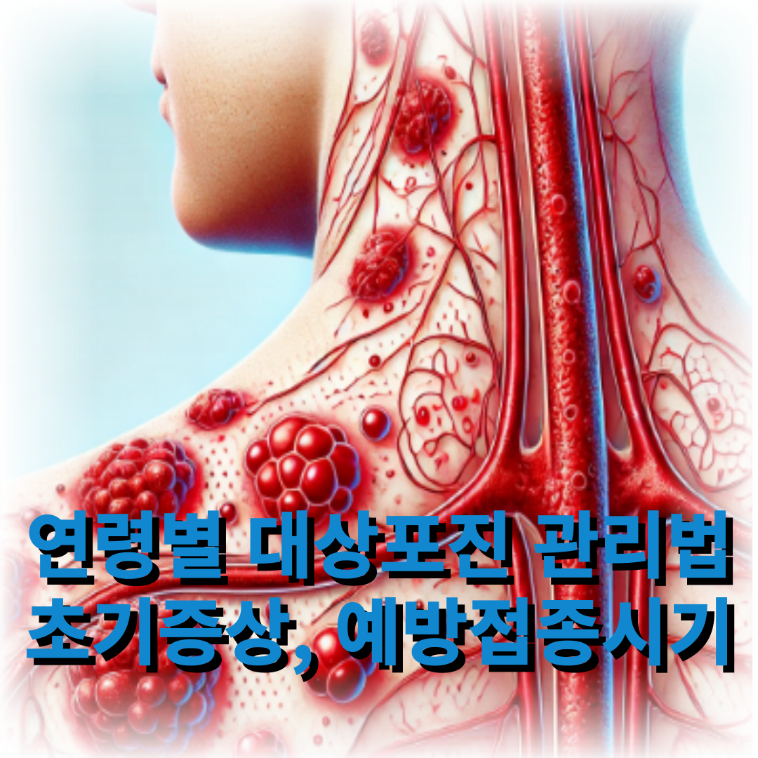 대상포진 연령별 대처법. 예방접종
