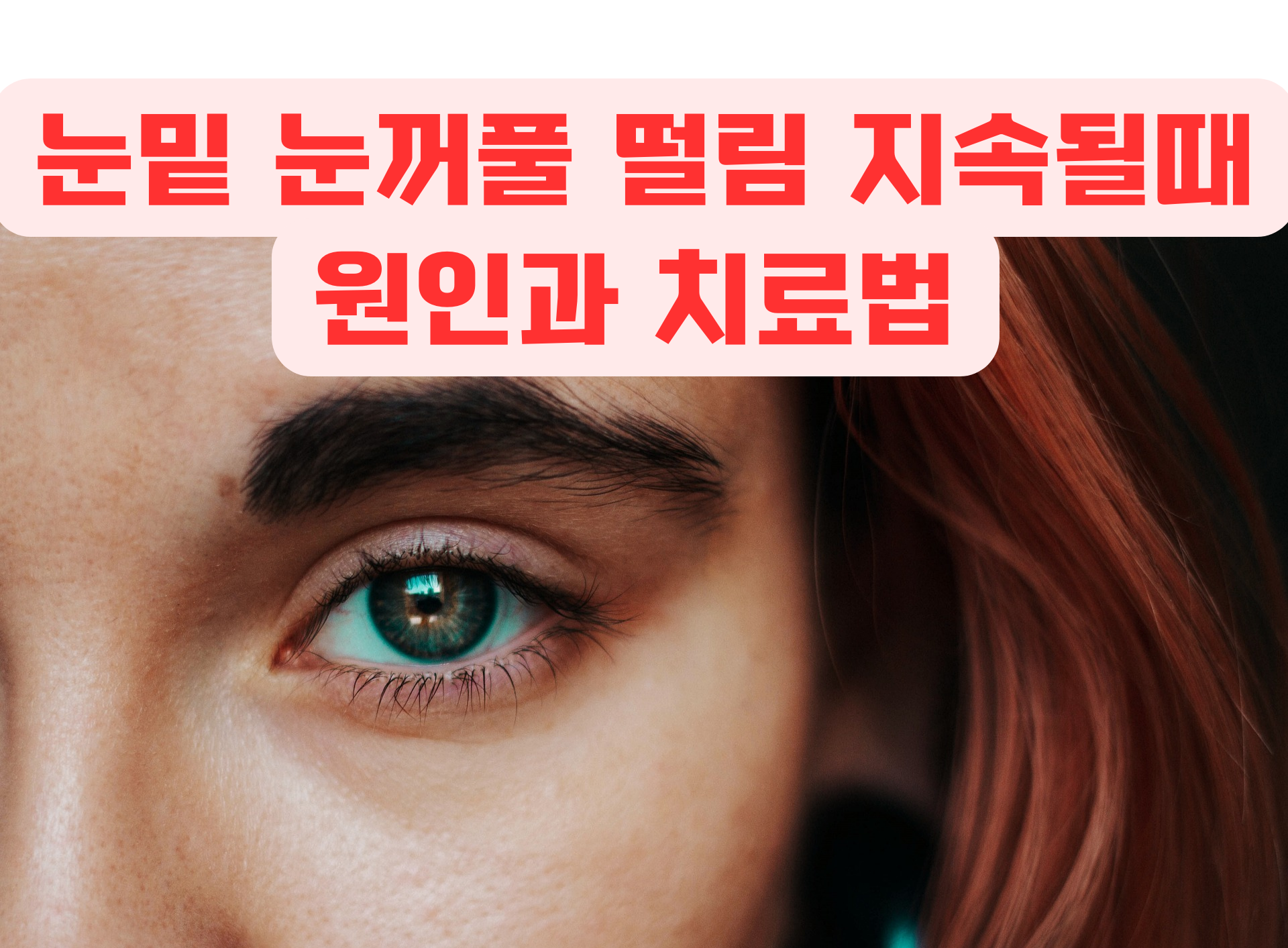 눈밑과 눈꺼풀 떨림 차이점과 지속될때 원인 , 치료법
